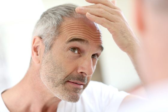 ¿La psoriasis puede provocar caída de cabello?